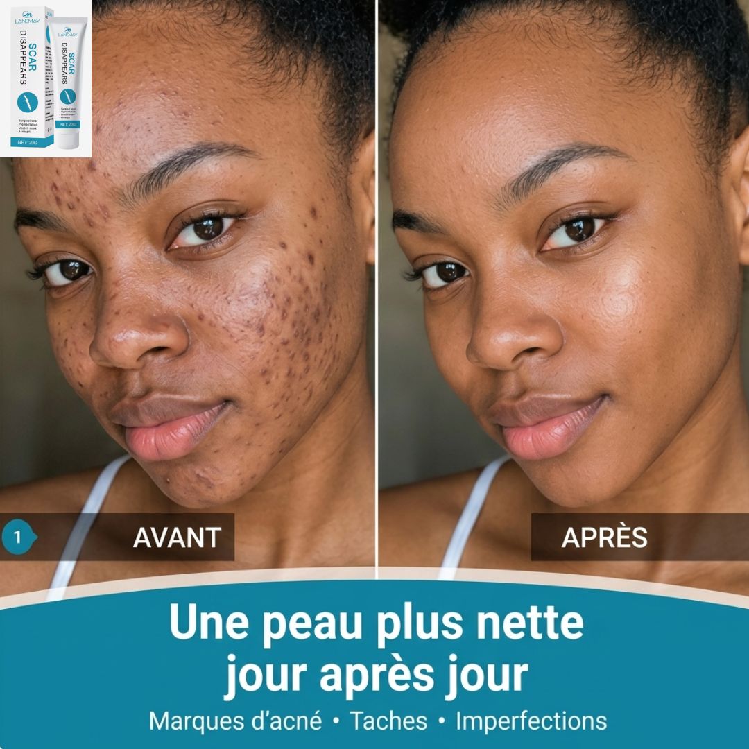 Gel Réparateur de la Peau pour Eliminer les Marques d'acné, les Boutons, les Vergetures et les Cicatrices