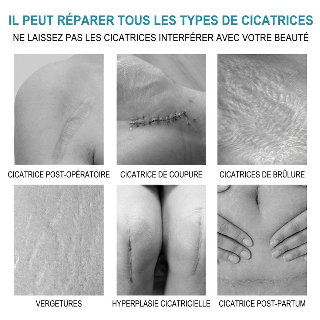 Gel Réparateur de la Peau pour Eliminer les Marques d'acné, les Boutons, les Vergetures et les Cicatrices