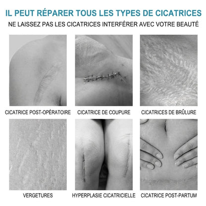Gel Réparateur de la Peau pour Eliminer les Marques d'acné, les Boutons, les Vergetures et les Cicatrices