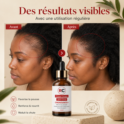 Serum Anti-Chute pour Cheveux