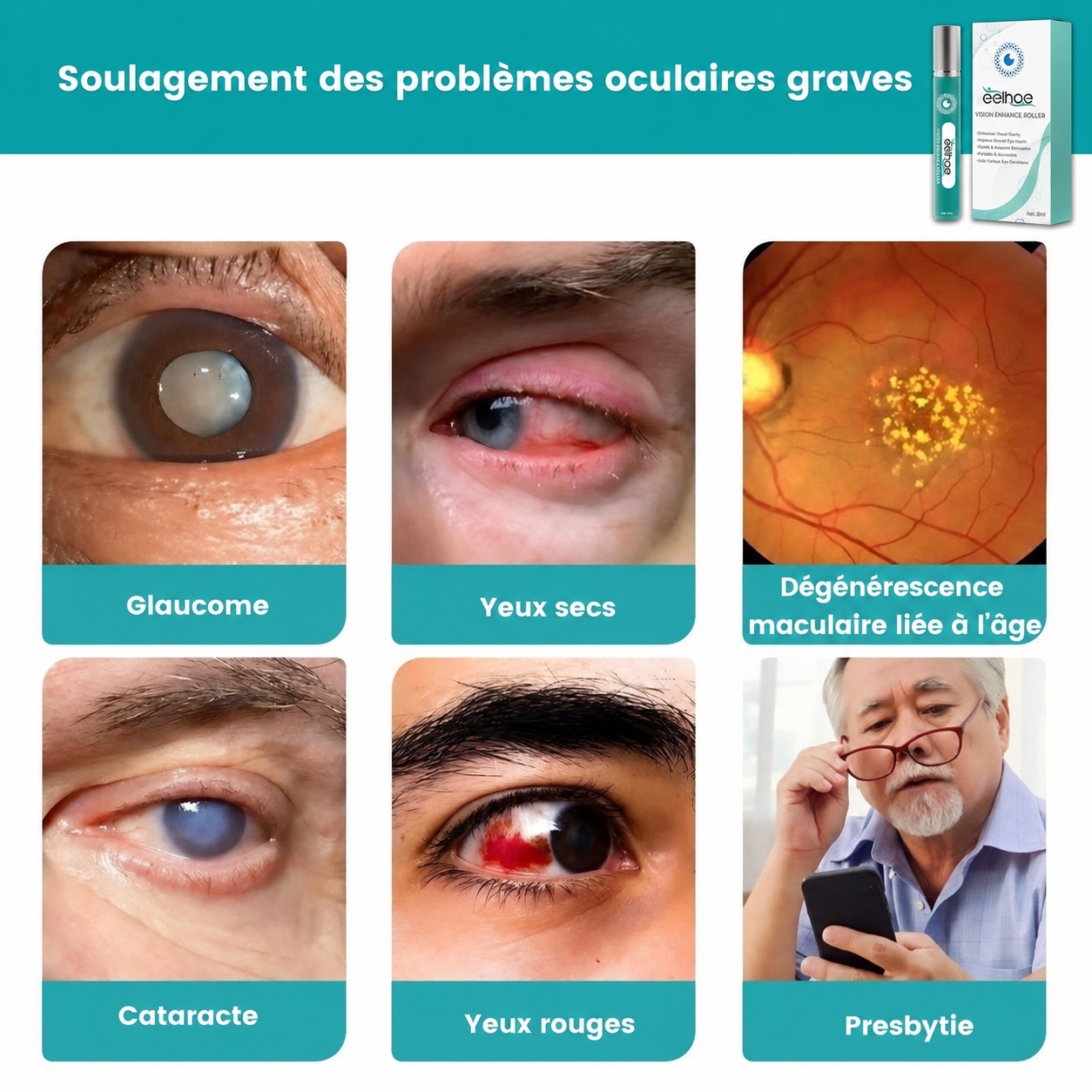 Appareil de Massage Oculaire pour Améliorer la Vision et Soulager la Fatigue