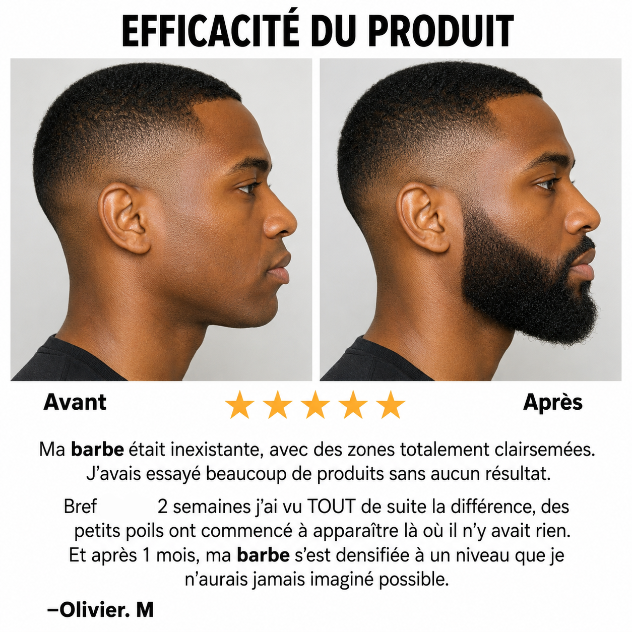 Complément de Turkesterone et Tongkat Ali - Pour Un Meilleur Equilibre Hormonal et Une Croissance de Barbe et Cheveux