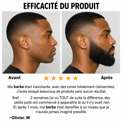 Complément de Turkesterone et Tongkat Ali - Pour Un Meilleur Equilibre Hormonal et Une Croissance de Barbe et Cheveux
