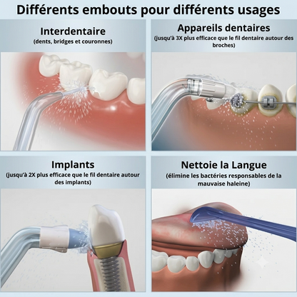 Hydropulseur Électrique pour Nettoyage Buccodentaire